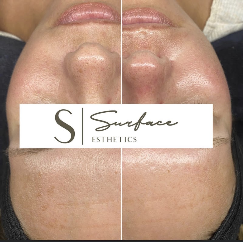 Surface Esthetics Spa, spa in Kokomo, IN, photo 3 of 9